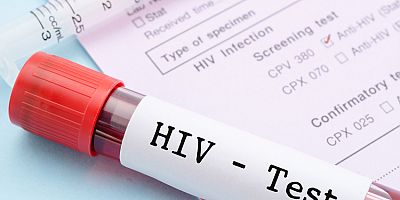 AIDS Hastalığında  Erken Tanı Önemli