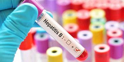 Dr. Koç’tan Hepatit' Uyarısı, “Çoğu Kişi Enfekte Olduğunun Farkında Değil”