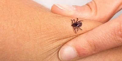 İl Sağlık Müdürü Kene  Uyarısında Bulundu